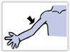 arm-CT.gif