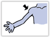 shoulder-CT.gif